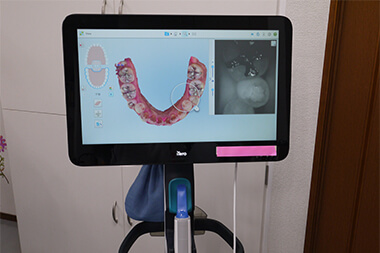 口腔内スキャンシステム2