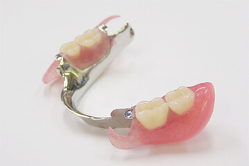 スマートデンチャー（チタン）