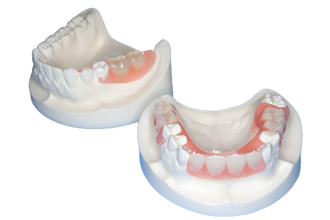 ミラクルデンチャー